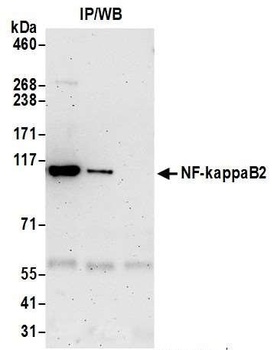 Rabbit anti-NF-kappaB2 Antibody, Affinity Purified