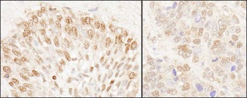 Rabbit anti-NUP50 Antibody, Affinity Purified