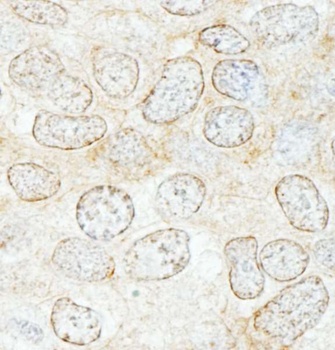 Rabbit anti-NUP50 Antibody, Affinity Purified