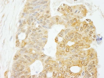 Rabbit anti-eIF4G1/eIF4GI Antibody, Affinity Purified