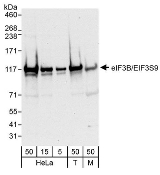Rabbit anti-eIF3B/EIF3S9 Antibody, Affinity Purified