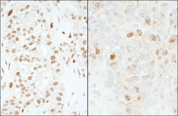 Rabbit anti-FOXK1 Antibody, Affinity Purified