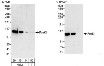 Rabbit anti-FOXK1 Antibody, Affinity Purified