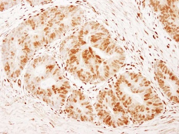 Rabbit anti-FOXK1 Antibody, Affinity Purified