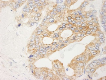 Rabbit anti-Filamin B Antibody, Affinity Purified