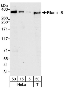 Rabbit anti-Filamin B Antibody, Affinity Purified
