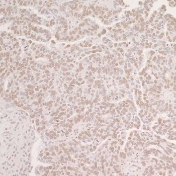 Rabbit anti-OCT1 Antibody, Affinity Purified