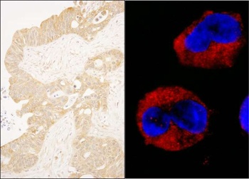 Rabbit anti-cAbl Antibody, Affinity Purified