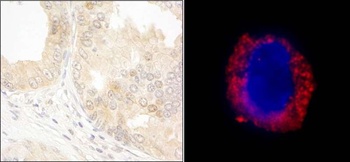Rabbit anti-cAbl Antibody, Affinity Purified