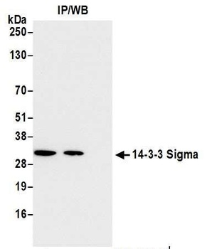 Rabbit anti-14-3-3 Sigma Antibody, Affinity Purified