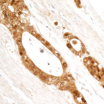 Rabbit anti-14-3-3 Sigma Antibody, Affinity Purified