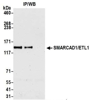 Rabbit anti-SMARCAD1/ETL1 Antibody, Affinity Purified