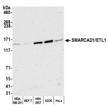 Rabbit anti-SMARCAD1/ETL1 Antibody, Affinity Purified