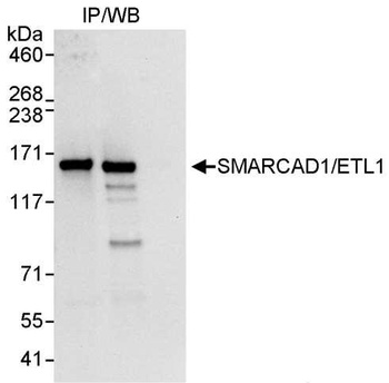 Rabbit anti-SMARCAD1/ETL1 Antibody, Affinity Purified