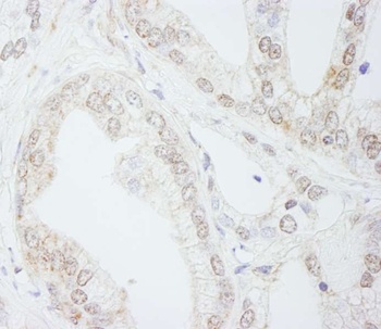 Rabbit anti-METTL3/MT-A70 Antibody, Affinity Purified