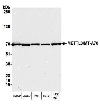 Rabbit anti-METTL3/MT-A70 Antibody, Affinity Purified