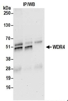 Rabbit anti-WDR4 Antibody, Affinity Purified