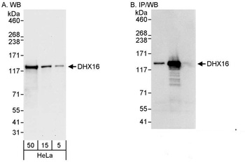 Rabbit anti-DHX16 Antibody, Affinity Purified