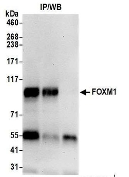 Rabbit anti-FOXM1 Antibody, Affinity Purified