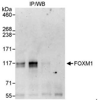 Rabbit anti-FOXM1 Antibody, Affinity Purified