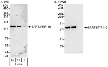 Rabbit anti-SART3/TIP110 Antibody, Affinity Purified
