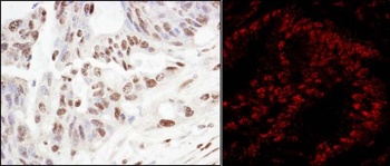 Rabbit anti-SART3/TIP110 Antibody, Affinity Purified