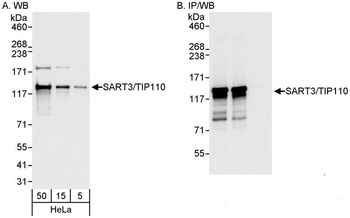 Rabbit anti-SART3/TIP110 Antibody, Affinity Purified
