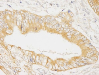 Rabbit anti-MAP4K4/HGK Antibody, Affinity Purified