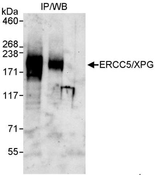 Rabbit anti-ERCC5/XPG Antibody, Affinity Purified