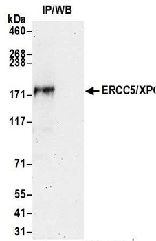 Rabbit anti-ERCC5/XPG Antibody, Affinity Purified