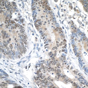 Rabbit anti-ERCC5/XPG Antibody, Affinity Purified