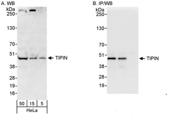 Rabbit anti-TIPIN Antibody, Affinity Purified