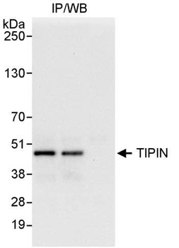 Rabbit anti-TIPIN Antibody, Affinity Purified