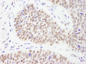 Rabbit anti-PHF6 Antibody, Affinity Purified