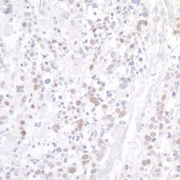 Rabbit anti-WDR79 Antibody, Affinity Purified