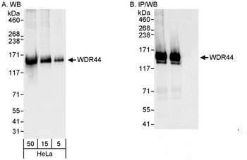 Rabbit anti-WDR44 Antibody, Affinity Purified