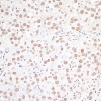 Rabbit anti-WTAP Antibody, Affinity Purified
