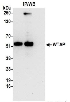 Rabbit anti-WTAP Antibody, Affinity Purified