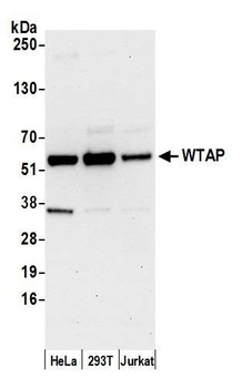 Rabbit anti-WTAP Antibody, Affinity Purified