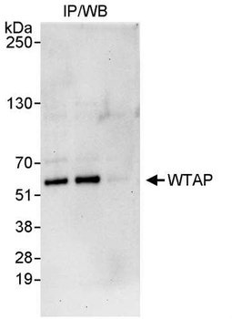 Rabbit anti-WTAP Antibody, Affinity Purified