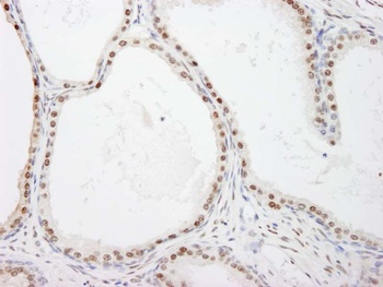 Rabbit anti-FKBP5/FKBP51 Antibody, Affinity Purified