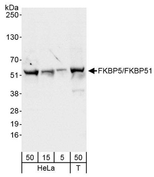 Rabbit anti-FKBP5/FKBP51 Antibody, Affinity Purified