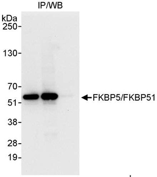 Rabbit anti-FKBP5/FKBP51 Antibody, Affinity Purified