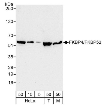 Rabbit anti-FKBP4/FKBP52 Antibody, Affinity Purified