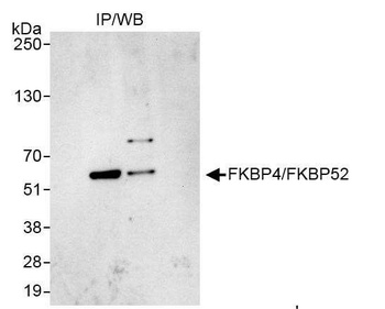 Rabbit anti-FKBP4/FKBP52 Antibody, Affinity Purified