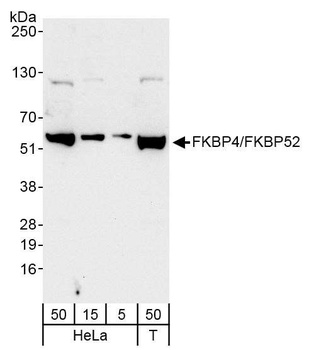 Rabbit anti-FKBP4/FKBP52 Antibody, Affinity Purified