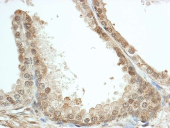 Rabbit anti-FKBP4/FKBP52 Antibody, Affinity Purified