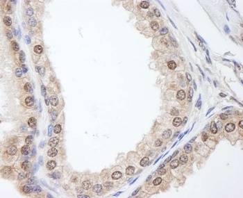 Rabbit anti-FKBP4/FKBP52 Antibody, Affinity Purified