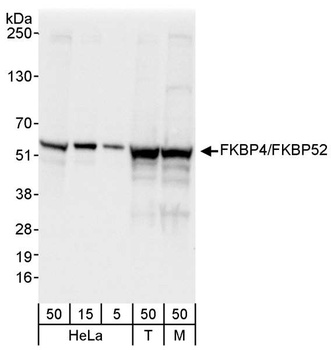 Rabbit anti-FKBP4/FKBP52 Antibody, Affinity Purified