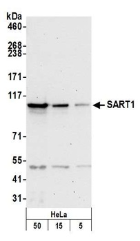 Rabbit anti-SART1 Antibody, Affinity Purified